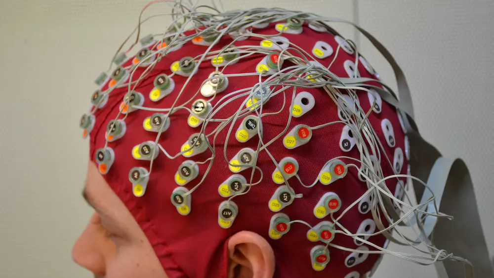 Electroencephalography-EEG brain scan type