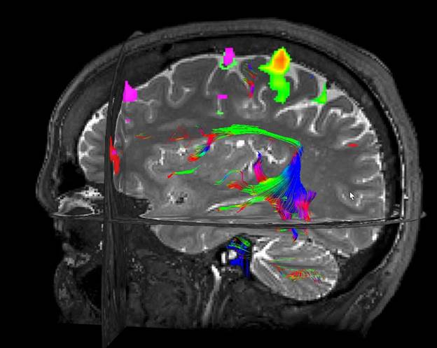 Functional-Magnetic-Resonance-Imaging-fMRI