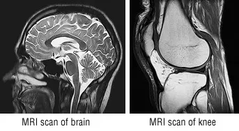 brain scan types